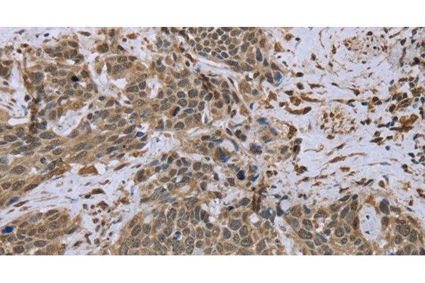 Dynactin 4 antibody