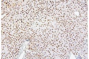 IHC analysis of H1F0 using anti-H1F0 antibody (ABIN7600521). (Histone H1 antibody  (AA 20-159))