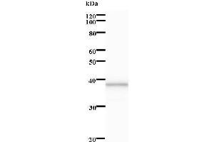 Western Blotting (WB) image for anti-Leucine Rich Repeat (In FLII) Interacting Protein 2 (LRRFIP2) antibody (ABIN932216) (LRRFIP2 antibody)