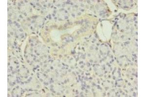 Immunohistochemistry (IHC) image for anti-Eukaryotic Translation Initiation Factor 4E Binding Protein 3 (EIF4EBP3) (AA 1-100) antibody (ABIN7152205)