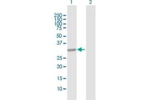 Western Blot analysis of CBR1 expression in transfected 293T cell line by CBR1 MaxPab polyclonal antibody. (CBR1 antibody  (AA 1-277))