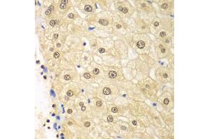 Immunohistochemistry of paraffin-embedded human liver injury using PSMD2 antibody (ABIN5971041) at dilution of 1/100 (40x lens).