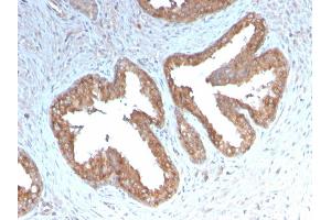 Immunohistochemistry (IHC) image for anti-Prostaglandin-Endoperoxide Synthase 2 (Prostaglandin G/H Synthase and Cyclooxygenase) (PTGS2) (AA 442-572) antibody (ABIN6940432)