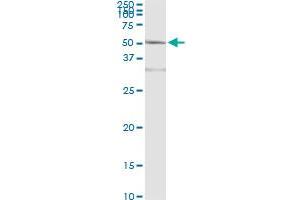 Immunoprecipitation of ACY1 transfected lysate using anti-ACY1 monoclonal antibody and Protein A Magnetic Bead , and immunoblotted with ACY1 MaxPab rabbit polyclonal antibody. (Aminoacylase 1 antibody  (AA 1-408))