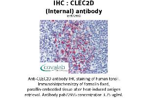 Image no. 2 for anti-C-Type Lectin Domain Family 2, Member D (CLEC2D) (Internal Region) antibody (ABIN1733154) (CLEC2D antibody  (Internal Region))