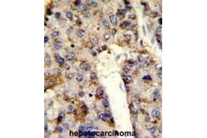 Immunohistochemistry (IHC) image for anti-Heterogeneous Nuclear Ribonucleoprotein L (HNRNPL) antibody (ABIN3001739) (HNRNPL antibody)