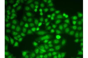 Immunofluorescence analysis of MCF-7 cell using PYCARD antibody. (PYCARD antibody  (AA 50-195))