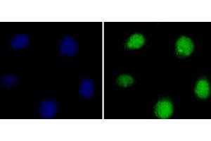 Immunofluorescence analysis of 293T cells using Symmetric DiMethyl-Histone H3-R8 Polyclonal Antibody (Histone 3 antibody  (H3R8me2s))