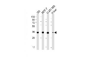 All lanes : Anti-PDXK Antibody (N-term) at 1:4000 dilution Lane 1: 293 whole cell lysate Lane 2: MCF-7 whole cell lysate Lane 3: U-251 MG whole cell lysate Lane 4: Human liver lysate Lysates/proteins at 20 μg per lane. (PDXK antibody  (AA 1-312))