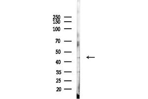 Western blot analysis of lysates from LoVo cells(heat-shock,45 min treatment), using IL18BP Antibody at 1/1000 dilution.