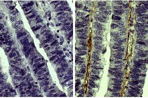 Collagen Type V antibody