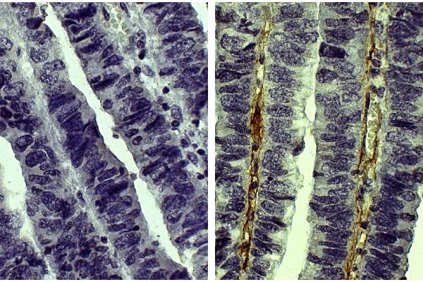 Collagen Type V antibody