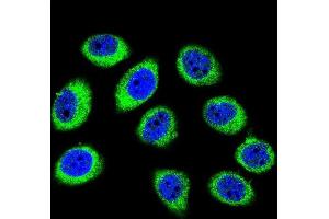 Confocal immunofluorescent analysis of GCLC Antibody (N-term) (ABIN655884 and ABIN2845285) with U-251MG cell followed by Alexa Fluor 488-conjugated goat anti-rabbit lgG (green). (GCLC antibody  (N-Term))