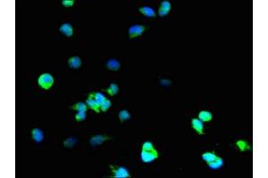 Immunofluorescent analysis of 293T cells using ABIN7170979 at dilution of 1:100 and Alexa Fluor 488-congugated AffiniPure Goat Anti-Rabbit IgG(H+L) (SOD1 antibody  (AA 2-154))