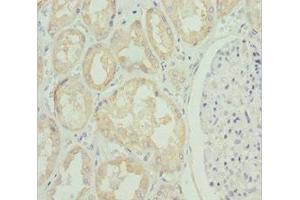 Immunohistochemistry of paraffin-embedded human kidney tissue using ABIN7176706 at dilution of 1:100 (SLC39A4 antibody  (AA 23-327))