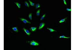 Immunofluorescent analysis of Hela cells using ABIN7170906 at dilution of 1:100 and Alexa Fluor 488-congugated AffiniPure Goat Anti-Rabbit IgG(H+L) (SUCNR1 antibody  (AA 303-334))