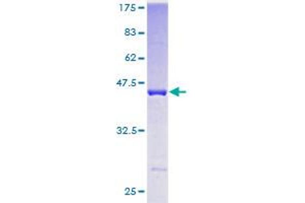 CPI-17 Protein (AA 1-147) (GST tag)