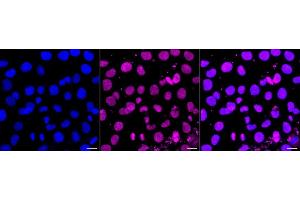 Immunocytochemical staining of HT- cells with SENP2 antibody (ABIN7800976), 1:1,000).