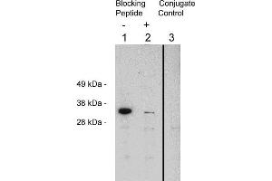 Western blot using  X1874P, rabbit polyclonal at 0. (FHL2 antibody)