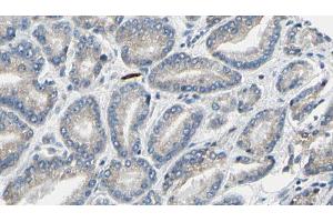 ABIN6269323 at 1/100 staining Human prostate tissue by IHC-P. (LIPE antibody  (Internal Region))