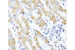Immunohistochemistry of paraffin-embedded Human stomach using CDKN2C Polyclonal Antibody at dilution of 1:100 (40x lens).