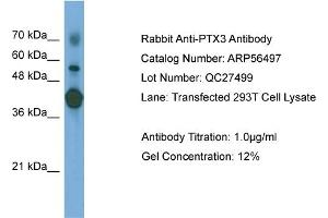 WB Suggested Anti-PTX3  Antibody Titration: 0. (PTX3 antibody  (N-Term))