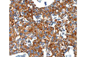 Immunohistochemistry (IHC) image for anti-Kallikrein 2 (KLK2) (AA 25-250) antibody (ABIN6219970)