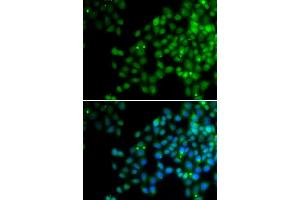 Immunofluorescence analysis of HeLa cells using EPC1 antibody. (EPC1 antibody)