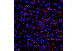 Immunofluorescence of paraffin embedded mouse brain using MAP9 (ABIN7074622) at dilution of 1:750 (300x lens) (MAP9 antibody)