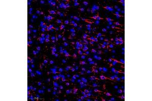 Immunofluorescence of paraffin embedded mouse brain using MAP9 (ABIN7074622) at dilution of 1:750 (300x lens) (MAP9 antibody)