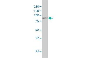 Western Blotting (WB) image for anti-Signal Transducer and Activator of Transcription 1, 91kDa (STAT1) (AA 613-712) antibody (ABIN563024)