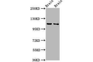 Western Blot Positive WB detected in: Rat brain tissue, Mouse brain tissue All lanes: CLIP2 antibody at 3. (CLIP2 antibody  (AA 101-217))