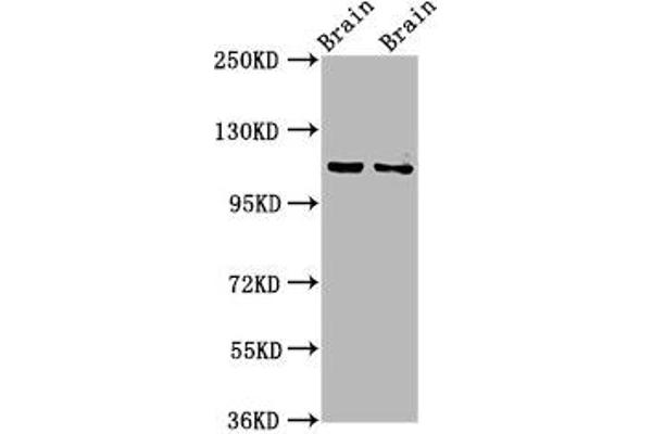 CLIP2 antibody  (AA 101-217)
