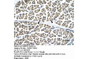 Human Muscle (GABRD antibody  (N-Term))