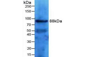 Detection of TFR2 in Mouse Kidney Tissue using Polyclonal Antibody to Transferrin Receptor 2 (TFR2) (Transferrin Receptor 2 antibody  (AA 86-259))