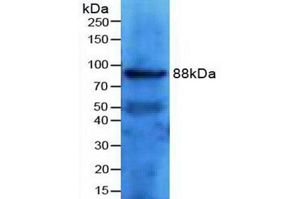 Transferrin Receptor 2 antibody  (AA 86-259)