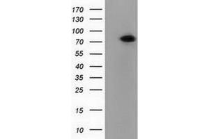 Western Blotting (WB) image for anti-Pseudouridylate Synthase 7 Homolog (PUS7) antibody (ABIN1500516) (PUS7 antibody)