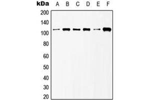 Western blot analysis of mGLUR6 expression in HeLa (A), NIH3T3 (B), Raw264. (Metabotropic Glutamate Receptor 6 antibody  (C-Term))