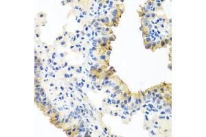 Immunohistochemistry of paraffin-embedded mouse lung using FECH antibody at dilution of 1:100 (x40 lens). (FECH antibody)