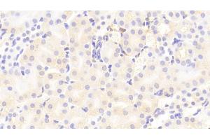 Detection of VCAM1 in Mouse Kidney Tissue using Polyclonal Antibody to Vascular Cell Adhesion Molecule 1 (VCAM1) (VCAM1 antibody  (AA 511-682))