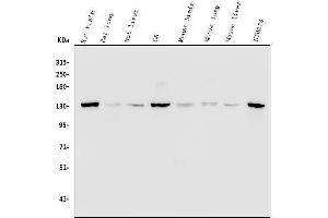 anti-Myosin Phosphatase, Target Subunit 1 (PPP1R12A) (AA 1-40), (N-Term) antibody