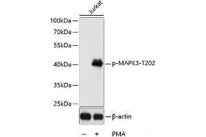 Western blot analysis of extracts of Jurkat cells using Phospho-MAPK3(T202) Polyclonal Antibody at dilution of 1:2000. (ERK1 antibody  (pThr202))