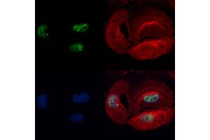 ABIN7093833 and ABIN7097876 staining Hela cells by IF/ICC.