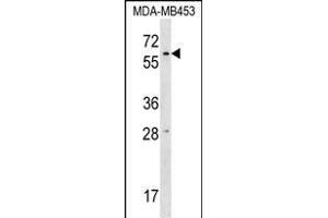 RPUSD2 Antibody (N-term) (ABIN1539609 and ABIN2848866) western blot analysis in MDA-M cell line lysates (35 μg/lane). (RPUSD2 antibody  (N-Term))