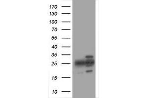 Image no. 1 for anti-Proteasome Subunit alpha 2 (PSMA2) (AA 50-234) antibody (ABIN1491571) (PSMA2 antibody  (AA 50-234))