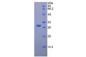 SDS-PAGE analysis of Rat Glucuronidase beta Protein. (Glucuronidase beta Protein)
