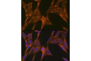 Immunofluorescence analysis of NIH-3T3 cells using ST Rabbit mAb (ABIN1681118, ABIN7101700, ABIN7101701 and ABIN7101702) at dilution of 1:100 (40x lens). (STAT4 antibody)