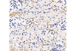 Immunohistochemistry analysis of paraffin-embedded mouse kidney using,NHE-3 (ABIN7075685) at dilution of 1: 1200 (SLC9A3 antibody)