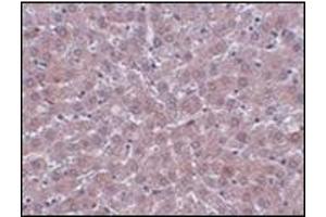 Immunohistochemistry of JMJD1B in rat liver tissue with this product at 2. (KDM3B antibody  (Center))