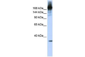 WB Suggested Anti-PRPF8 Antibody Titration:  0. (PRPF8 antibody  (N-Term))
